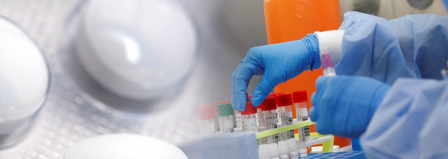 Doses d’hydroxychloroquine et tests de dépistage au CHU de Guadeloupe